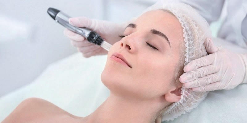 Microneedling