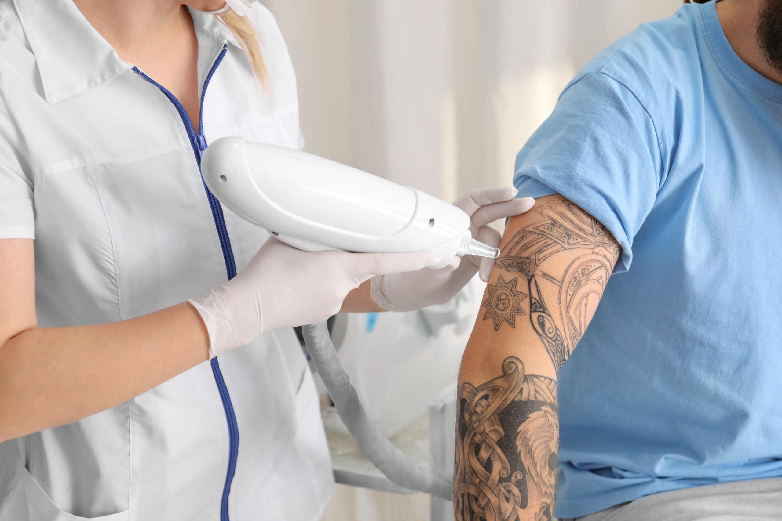 Why You Should Come To Us For Tattoo Removal - Laser NY